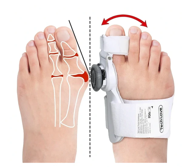 Bunion Corrector